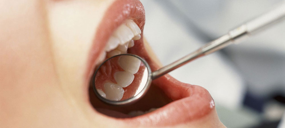 Root Canal Treatment Near me at Gachibowli