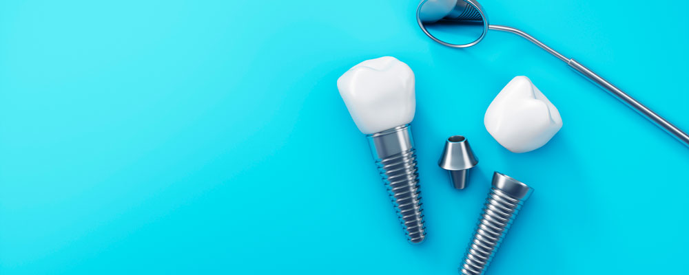 Dental Implants Near me at Gachibowli