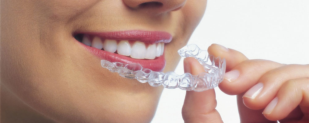 Invisalign in Gachibowli Hyderabad