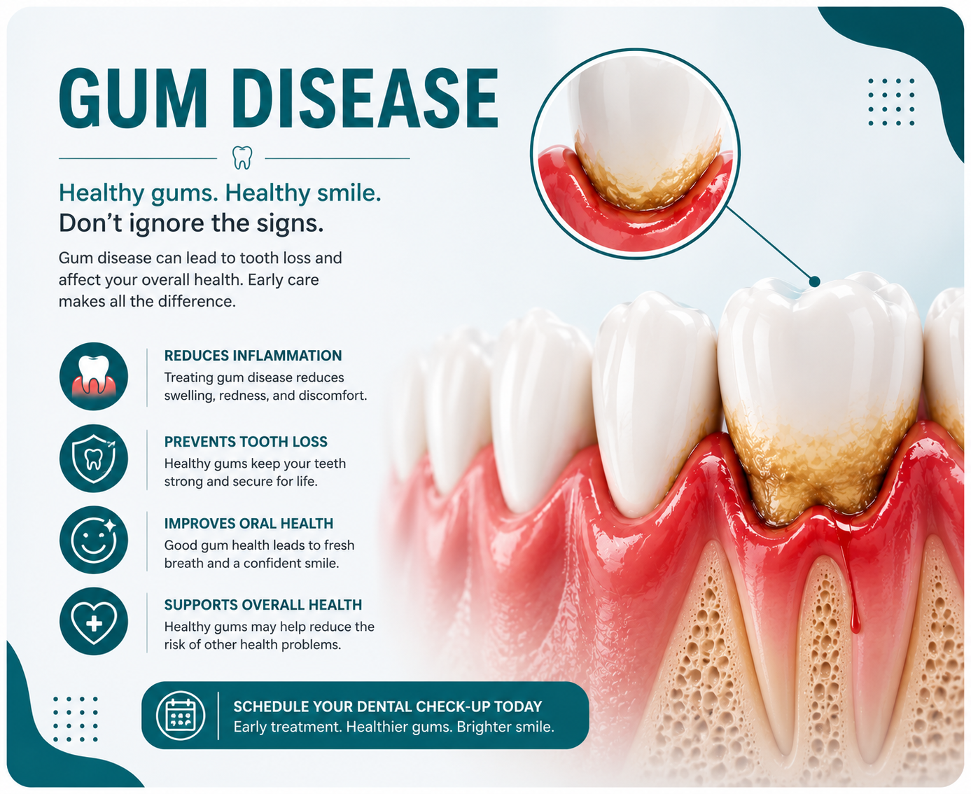 Gum disease