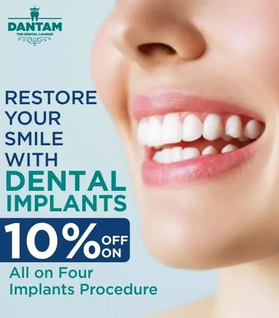 Invisalign Offer
