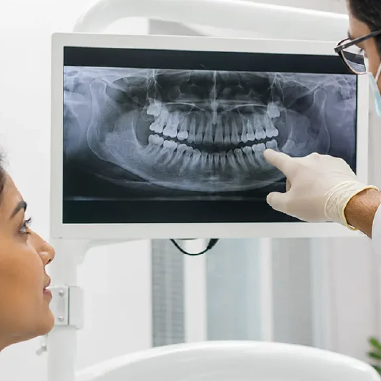 Dental X-rays / Digital Diagnosis image 01